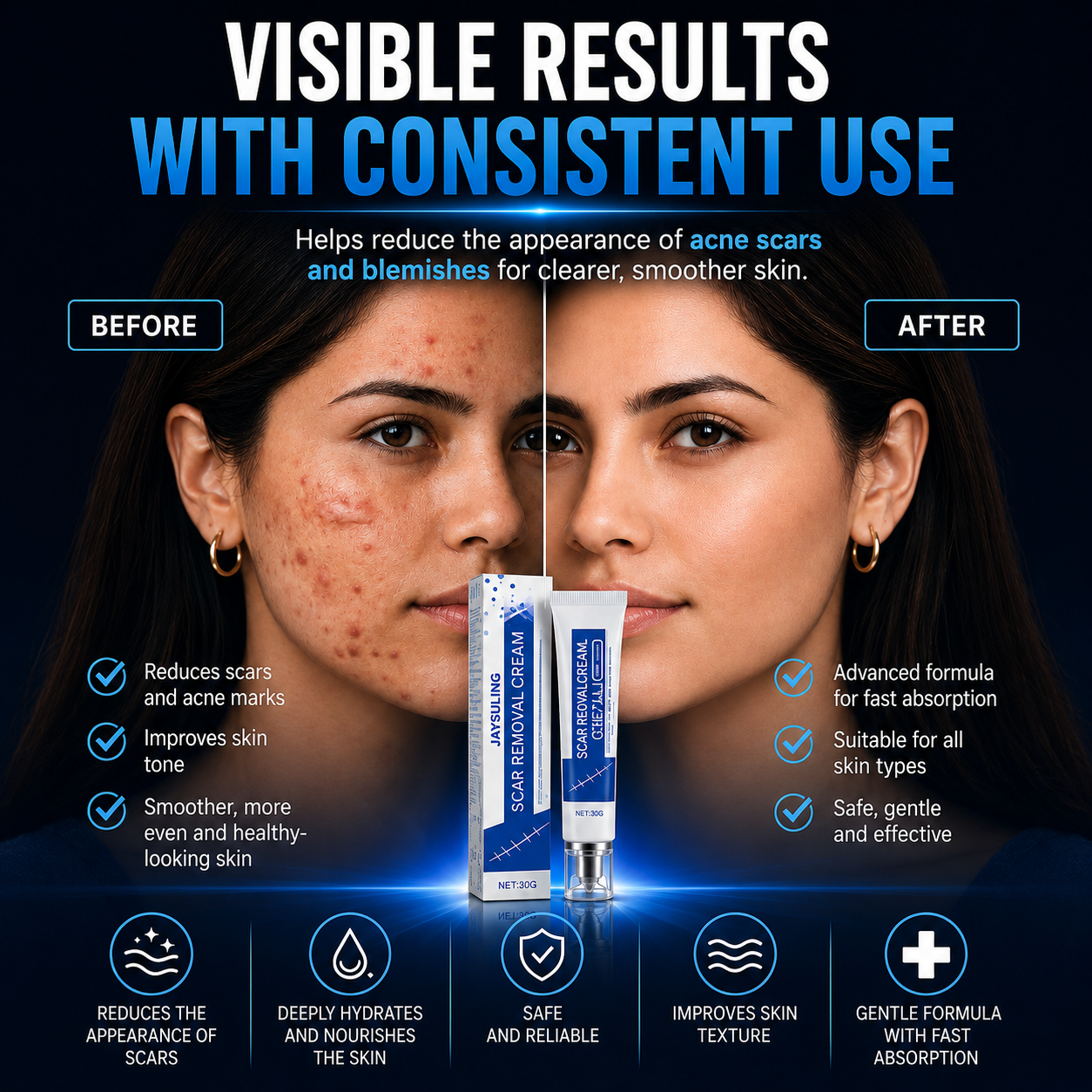ScarSmooth™- Great for all types of marks