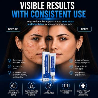 ScarSmooth™- Great for all types of marks